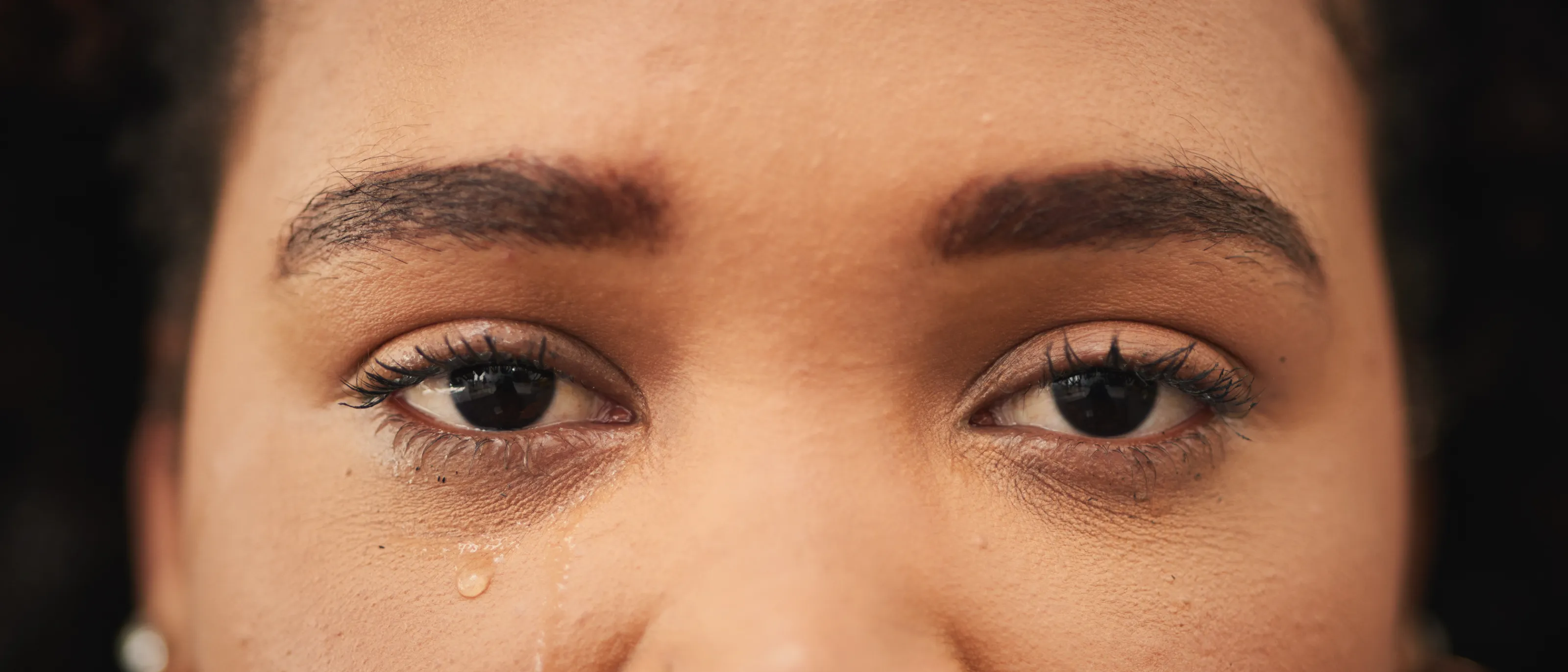 Female patient with watery right eye